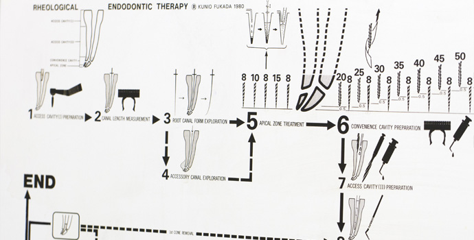 根管治療について