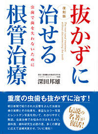 抜かずに治せる根管治療