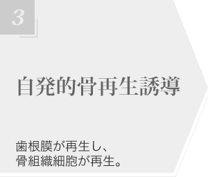 自発的骨再生誘導