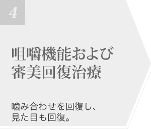 咀嚼機能および審美回復治療