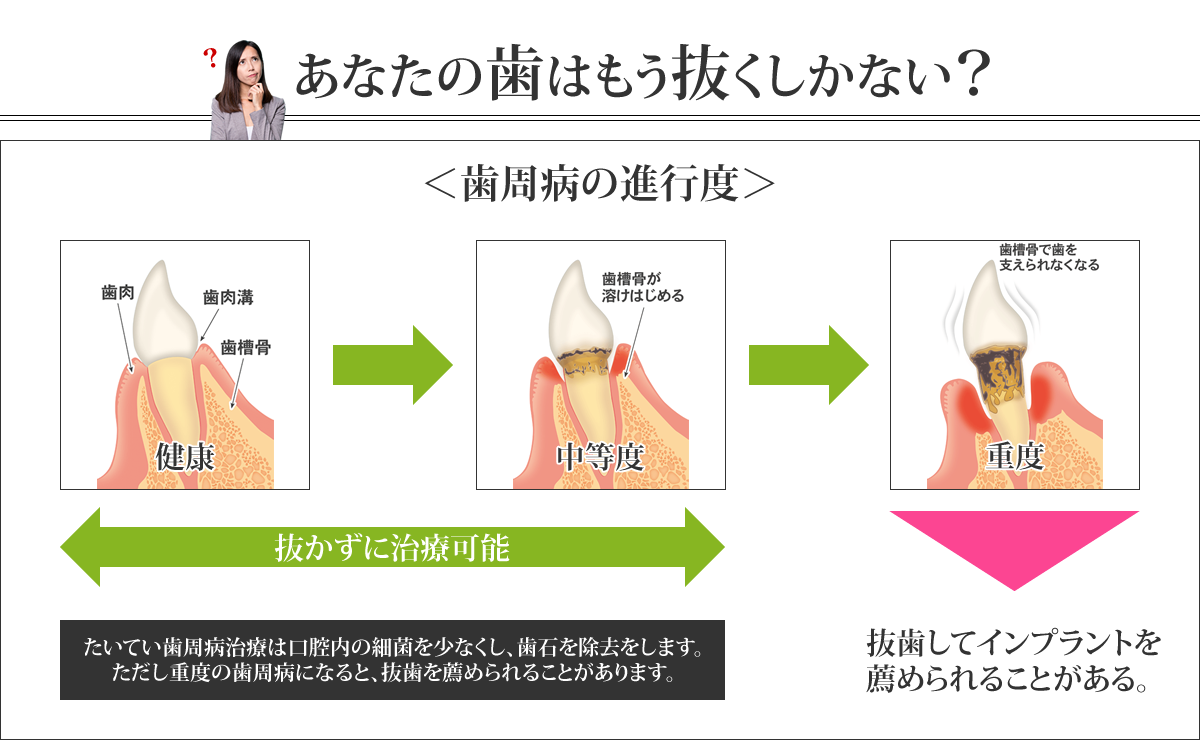 あなたの歯はもう抜くしかない？